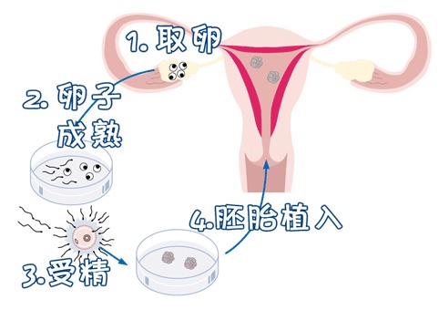 Fig.02
